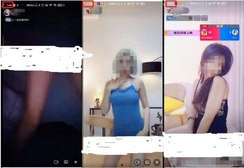 成人尿道改造视频播放,技术革新与康复之路